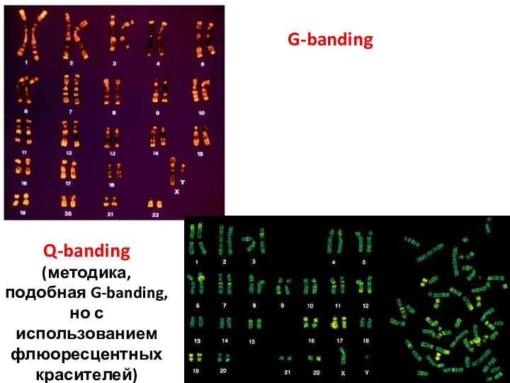 G-banding Q-banding (методика, подобная G-banding, но с использованием флюоресцентных красителей)
