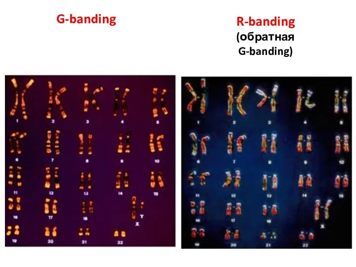 G-banding R-banding (обратная G-banding)