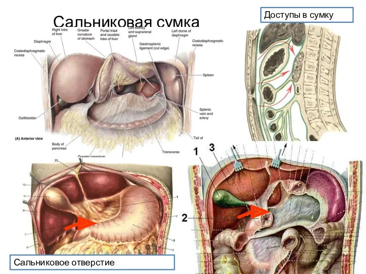 Сальниковая сумка Доступы в сумку Сальниковое отверстие