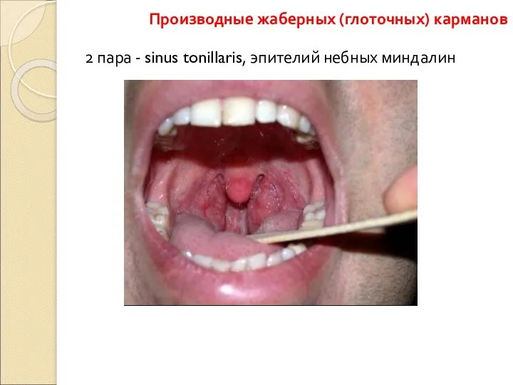 2 пара - sinus tonillaris, эпителий небных миндалин Производные жаберных (глоточных) карманов