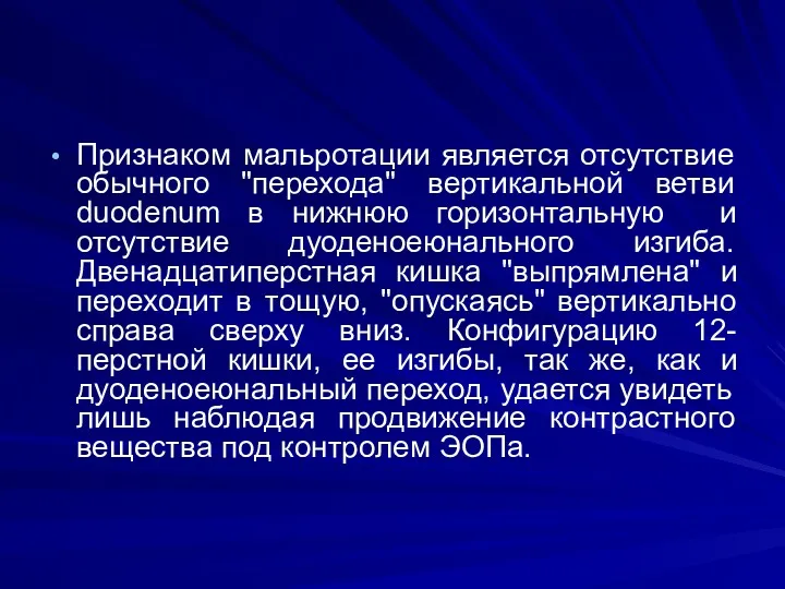 Признаком мальротации является отсутствие обычного "перехода" вертикальной ветви duodenum в