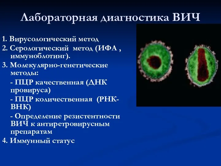 Лабораторная диагностика ВИЧ 1. Вирусологический метод 2. Серологический метод (ИФА