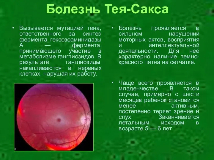 Болезнь Тея-Сакса Болезнь проявляется в сильном нарушении моторных актов, восприятия