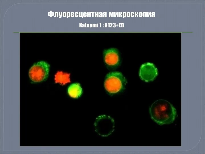 Флуоресцентная микроскопия Katsumi 1 : R123+EB