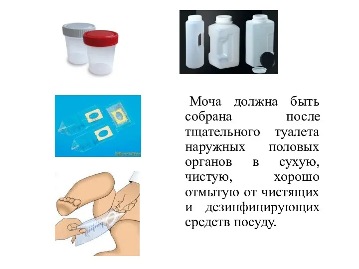 Моча должна быть собрана после тщательного туалета наружных половых органов