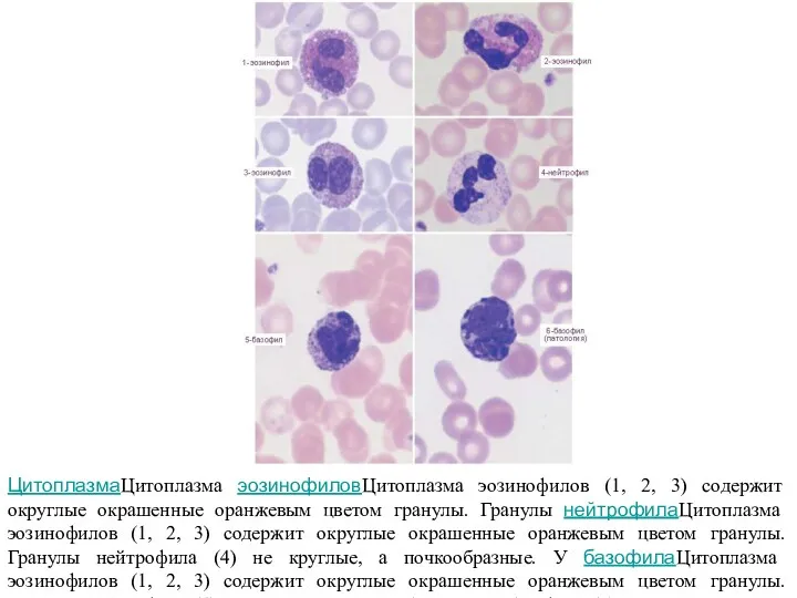ЦитоплазмаЦитоплазма эозинофиловЦитоплазма эозинофилов (1, 2, 3) содержит округлые окрашенные оранжевым