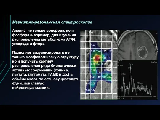 Магнитно-резонансная спектроскопия Анализ не только водорода, но и фосфора (например,