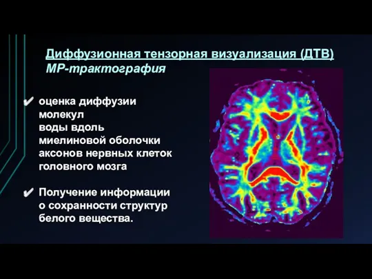 Диффузионная тензорная визуализация (ДТВ) МР-трактография оценка диффузии молекул воды вдоль