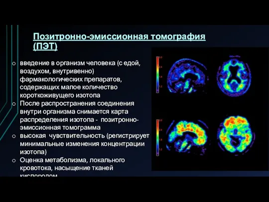 Позитронно-эмиссионная томография (ПЭТ) введение в организм человека (с едой, воз­духом,