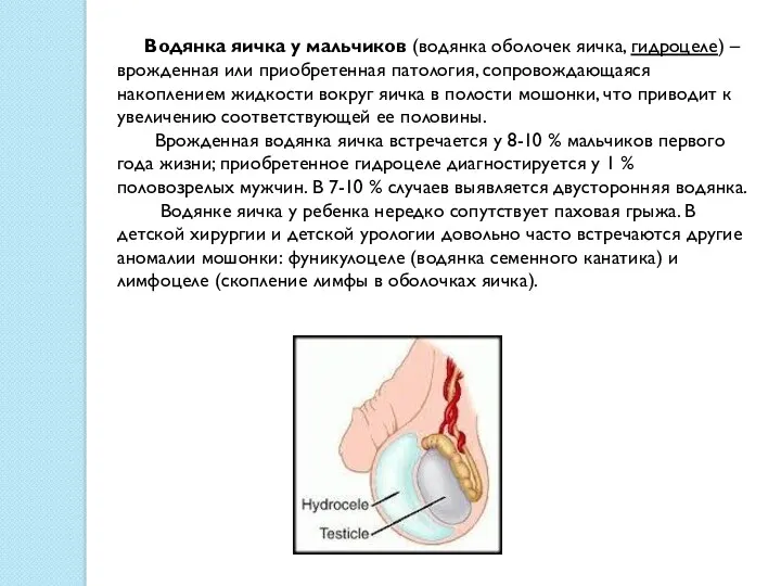 Водянка яичка у мальчиков (водянка оболочек яичка, гидроцеле) – врожденная