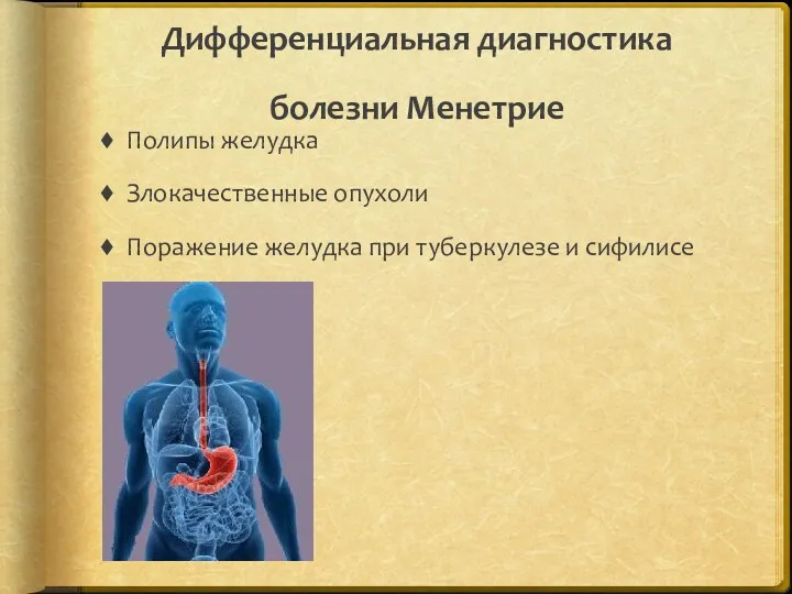 Дифференциальная диагностика болезни Менетрие Полипы желудка Злокачественные опухоли Поражение желудка при туберкулезе и сифилисе