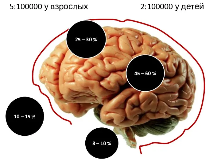 5:100000 у взрослых 2:100000 у детей 45 – 60 %