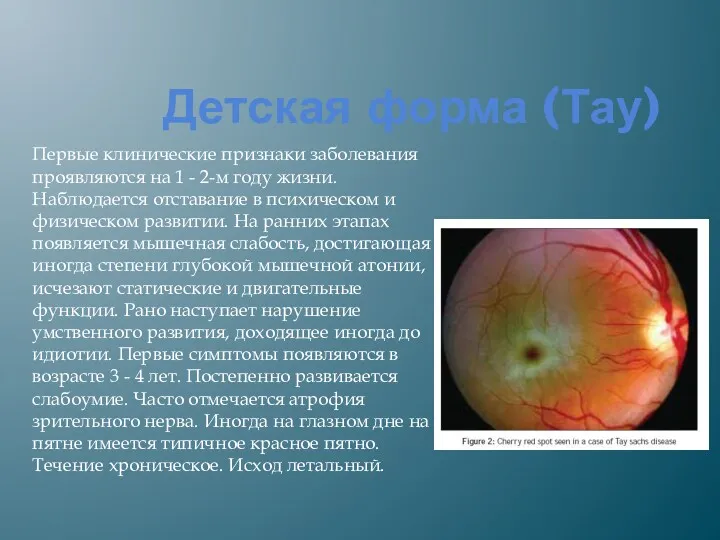 Детская форма (Тау) Первые клинические признаки заболевания проявляются на 1