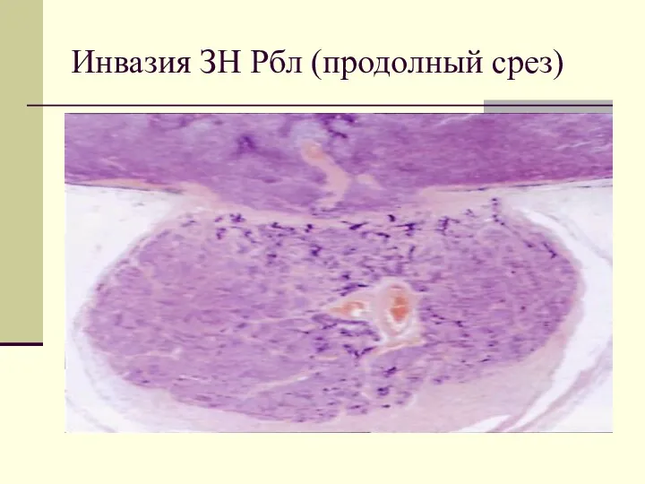 Инвазия ЗН Рбл (продолный срез)