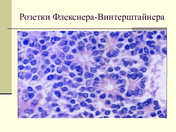 Розетки Флекснера-Винтерштайнера