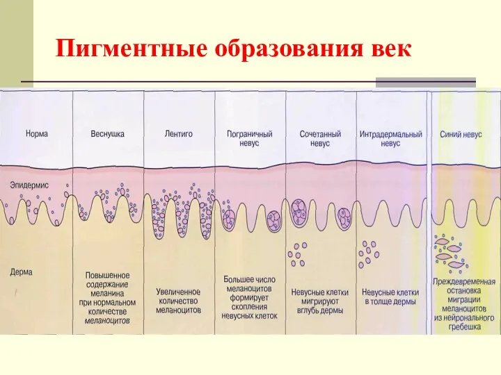 Пигментные образования век