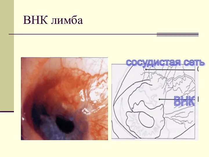 ВНК лимба ВНК сосудистая сеть