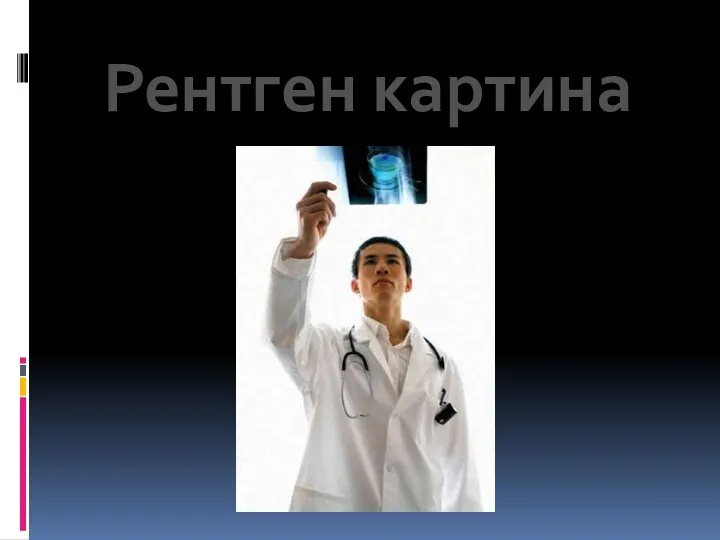 Рентген картина