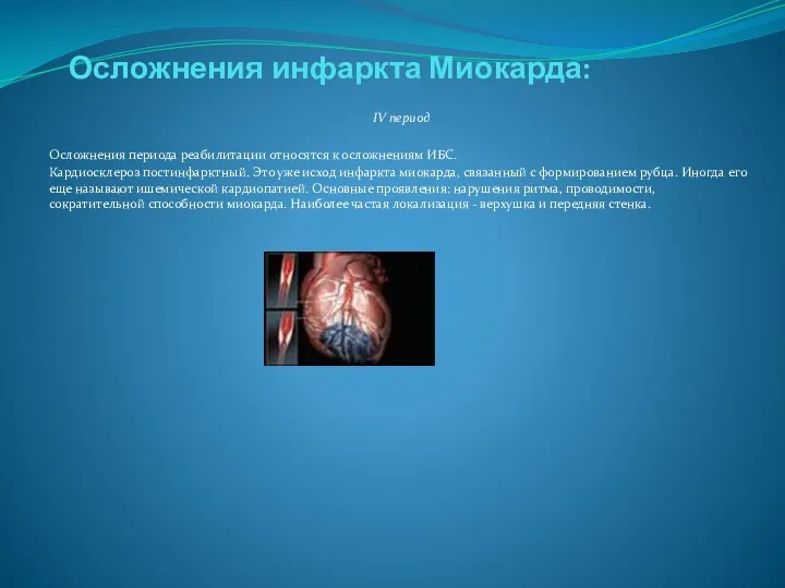 Осложнения инфаркта Миокарда: IV период Осложнения периода реабилитации относятся к