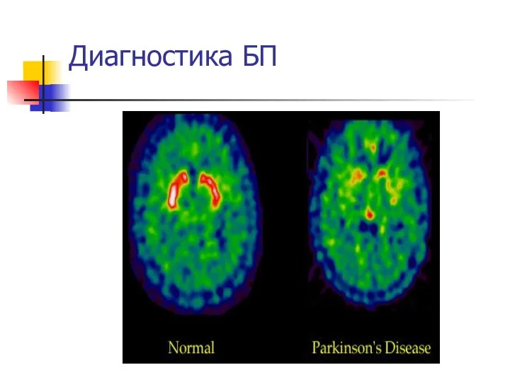 Диагностика БП