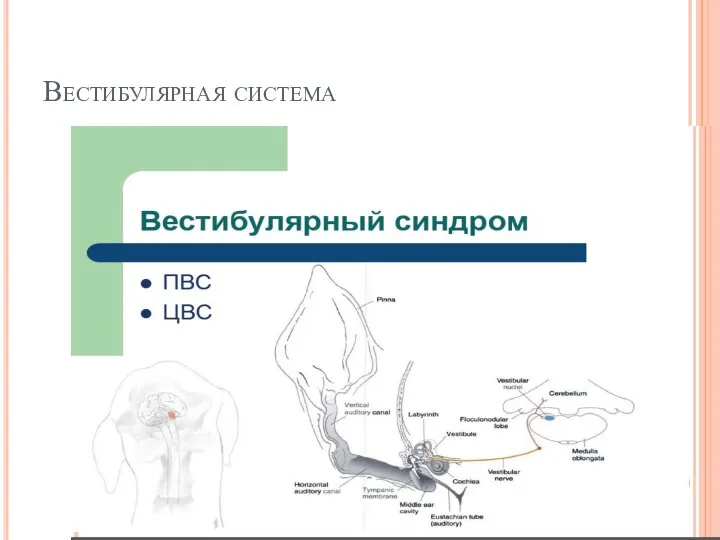 Вестибулярная система