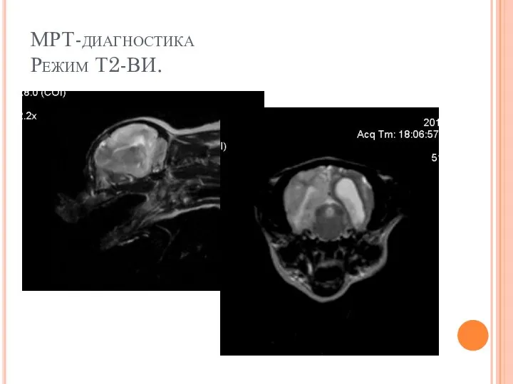 МРТ-диагностика Режим Т2-ВИ.