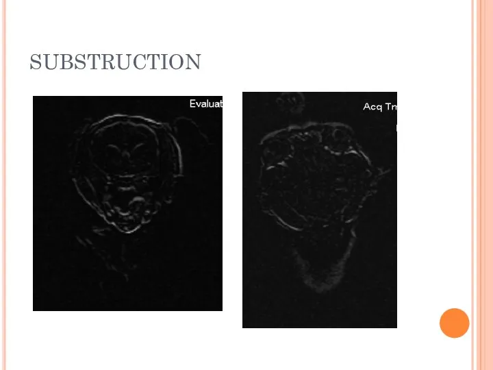 SUBSTRUCTION