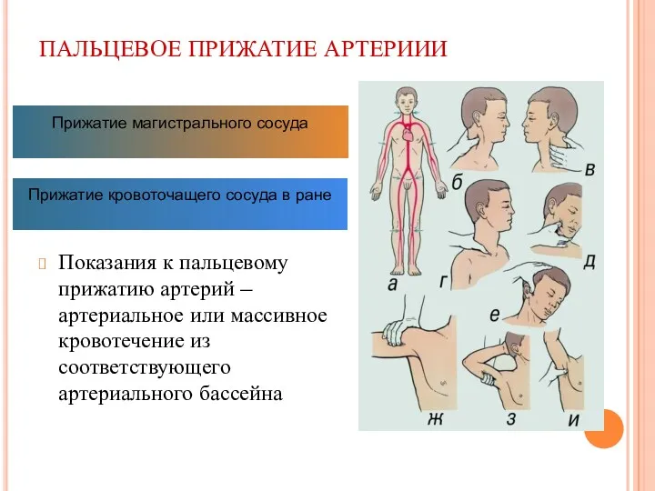 ПАЛЬЦЕВОЕ ПРИЖАТИЕ АРТЕРИИИ Показания к пальцевому прижатию артерий – артериальное