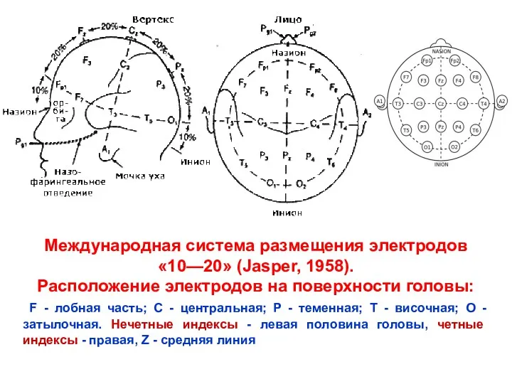 Международная система размещения электродов «10—20» (Jasper, 1958). Расположение электродов на