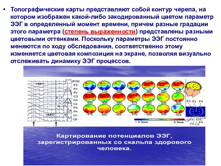 Топографические карты представляют собой контур черепа, на котором изображен какой-либо закодированный цветом параметр