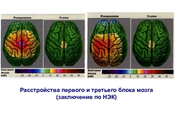 Расстройства первого и третьего блока мозга (заключение по НЭК)