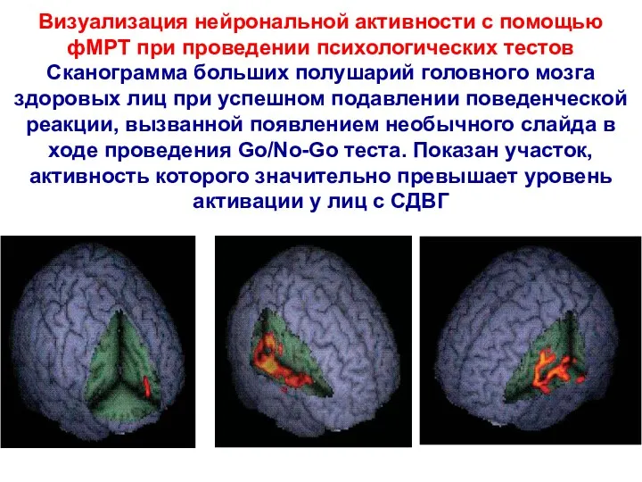 Визуализация нейрональной активности с помощью фМРТ при проведении психологических тестов Сканограмма больших полушарий