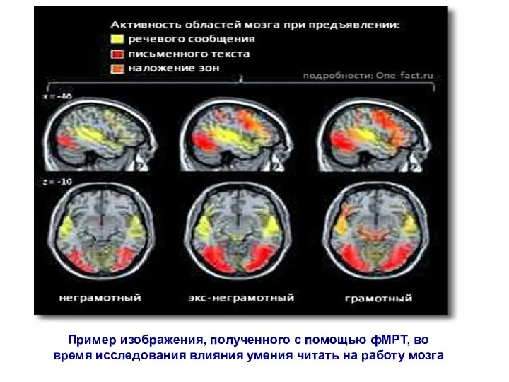 Пример изображения, полученного с помощью фМРТ, во время исследования влияния умения читать на работу мозга
