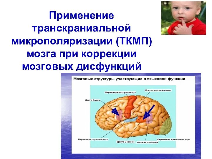Применение транскраниальной микрополяризации (ТКМП) мозга при коррекции мозговых дисфункций