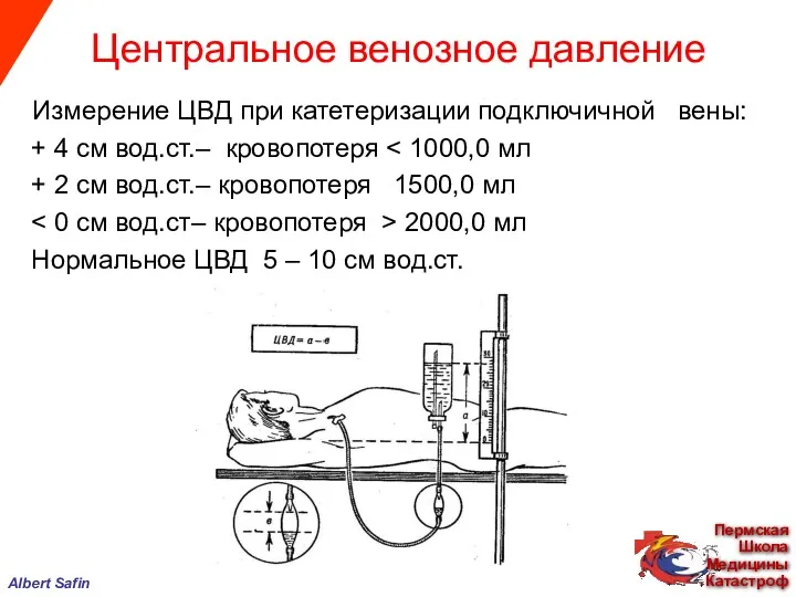 Измерение ЦВД при катетеризации подключичной вены: + 4 см вод.ст.– кровопотеря + 2