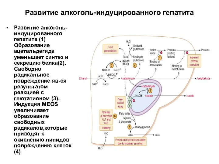 Развитие алкоголь-индуцированного гепатита Развитие алкоголь-индуцированного гепатита (1) Образование ацетальдегида уменьшает