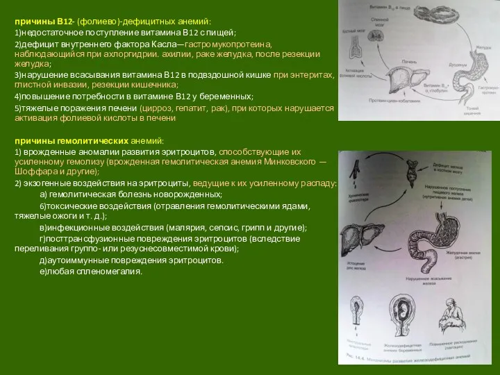 причины В12- (фолиево)-дефицитных анемий: 1)недостаточное поступление витамина В12 с пищей;