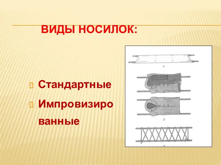 ВИДЫ НОСИЛОК: Стандартные Импровизированные