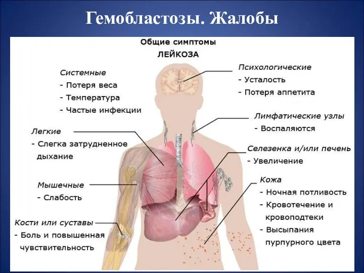 Гемобластозы. Жалобы