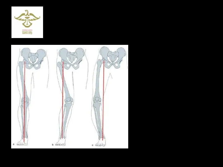 Биомеханическая ось нижних конечностей Тазобедренный сустав Коленный сустав Стопа и голеностопный сустав