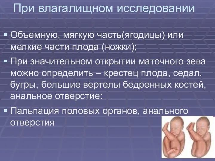 При влагалищном исследовании Объемную, мягкую часть(ягодицы) или мелкие части плода