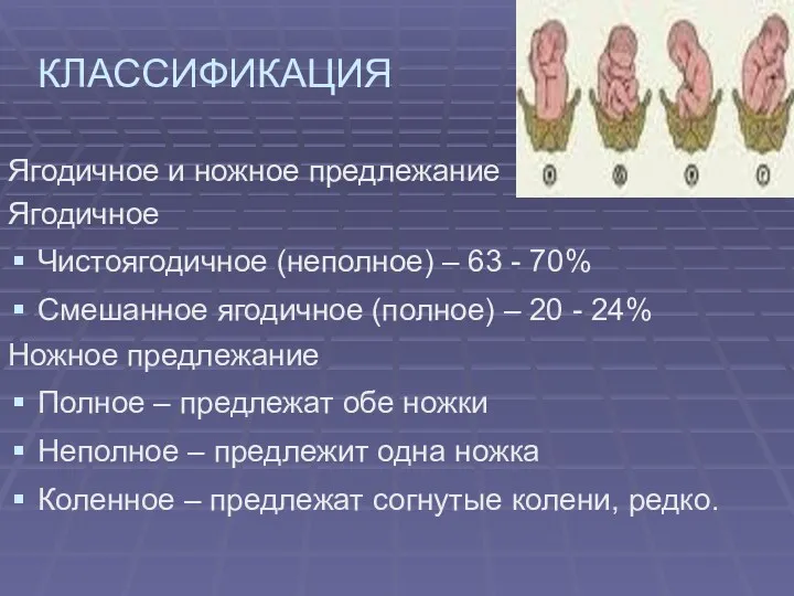 КЛАССИФИКАЦИЯ Ягодичное и ножное предлежание Ягодичное Чистоягодичное (неполное) – 63 - 70% Смешанное