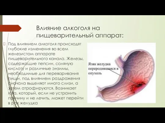 Влияние алкоголя на пищеварительный аппарат: Под влиянием алкоголя происходят глубокие