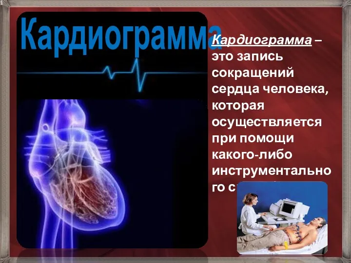 Кардиограмма Кардиограмма – это запись сокращений сердца человека, которая осуществляется при помощи какого-либо инструментального способа.