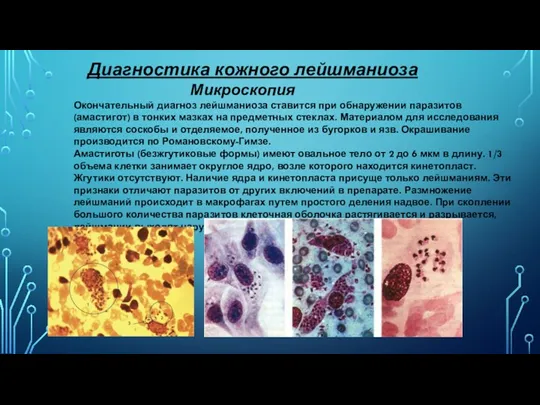 Диагностика кожного лейшманиоза Микроскопия Окончательный диагноз лейшманиоза ставится при обнаружении