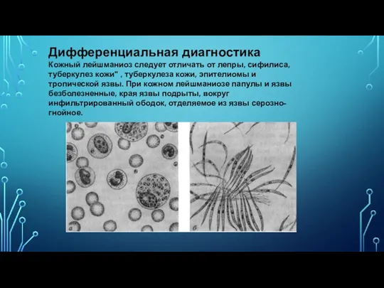 Дифференциальная диагностика Кожный лейшманиоз следует отличать от лепры, сифилиса, туберкулез