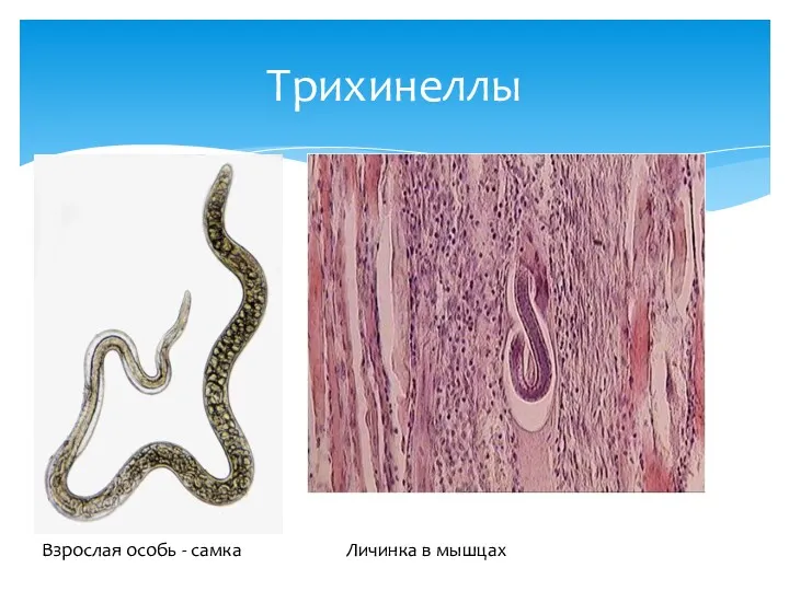 Трихинеллы Взрослая особь - самка Личинка в мышцах