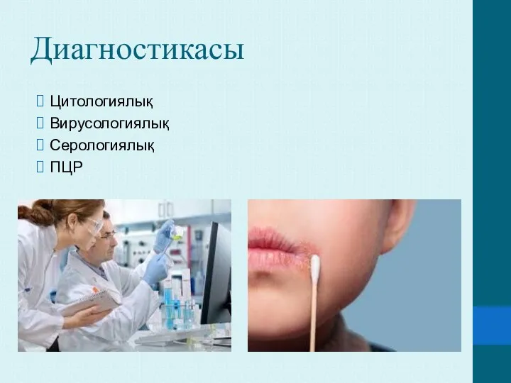 Диагностикасы Цитологиялық Вирусологиялық Серологиялық ПЦР