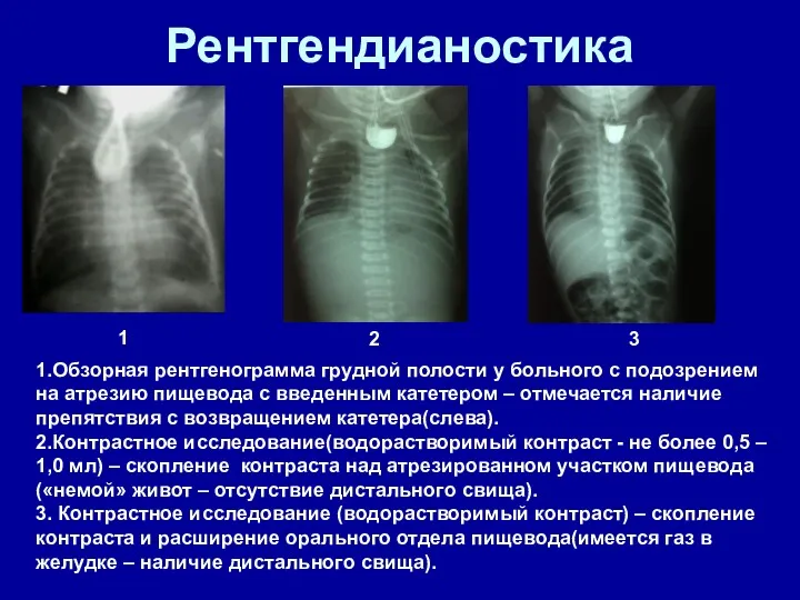 Рентгендианостика 1 2 3 1.Обзорная рентгенограмма грудной полости у больного с подозрением на