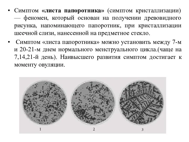 Симптом «листа папоротника» (симптом кристаллизации) — феномен, который основан на